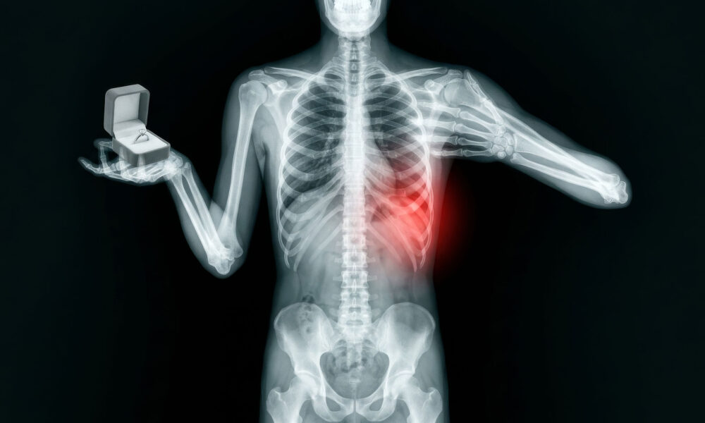 My Rib Dislocated Mid-Diamond Presentation. I Finished the Sale Anyway.